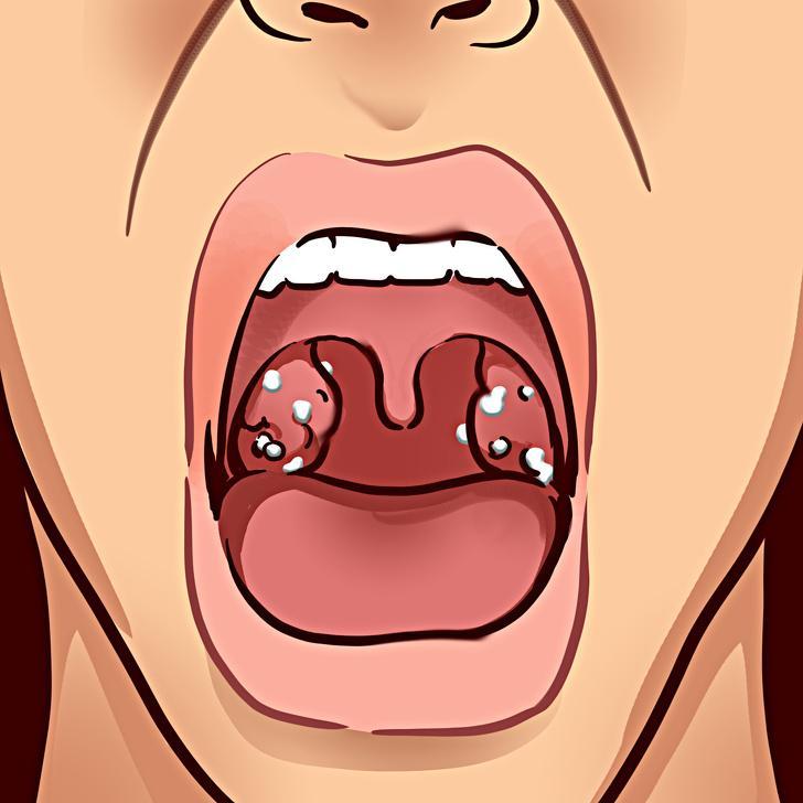 Imate neprijeten okus v ustih? Morda je kriv kateri izmed teh razlogov (osveženo 2021)
