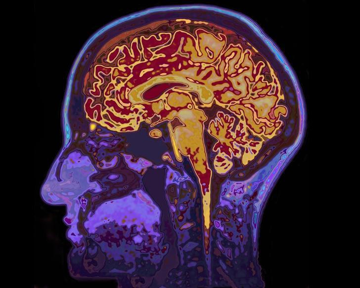 Nadvse čudna in zanimiva dejstva o človeških možganih