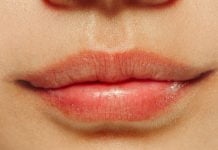 ustnice