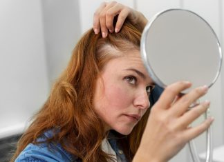 Zakaj vam jeseni pospešeno izpadajo lasje in kako to ustaviti? izpadanje-las